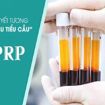 Công nghệ PRP - Liệu pháp hiện đại giúp xóa sẹo, trị nám, hồi sinh làn da hàng đầu