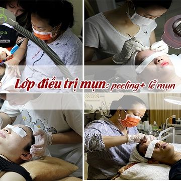 Lớp điều trị mụn: peeling+ lễ mụn